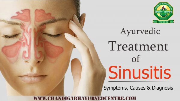 Ayurvedic Treatment for Sinusitis - Symptoms, Causes & Diagnosis