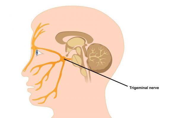 Cure Of Trigeminal Neuralgia