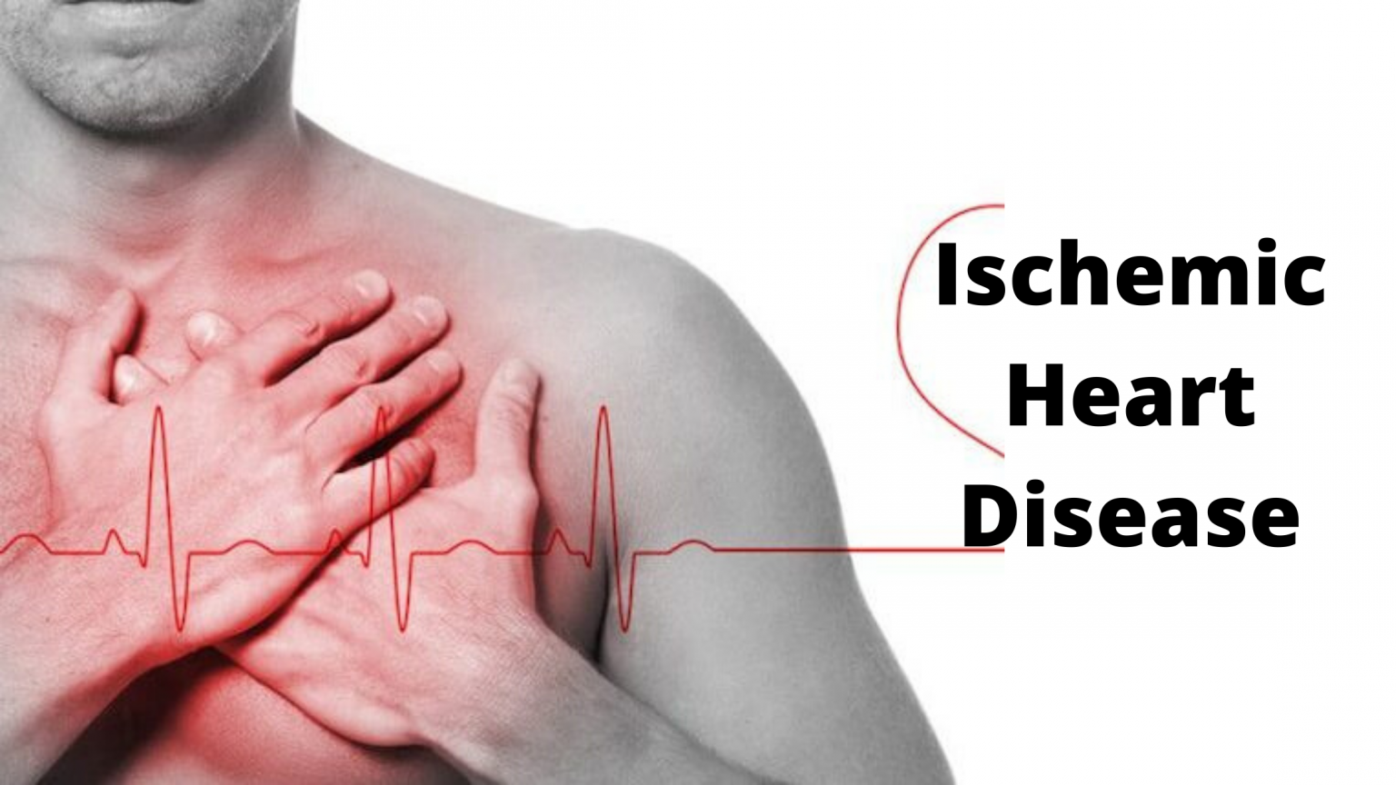 Ischemic Heart Disease - Herbal Remedies And Ayurvedic Treatment