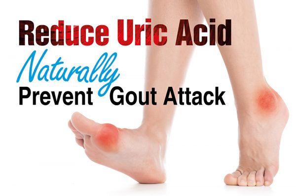 7 Effective Home Remedies to Reduce Uric Acid Naturally