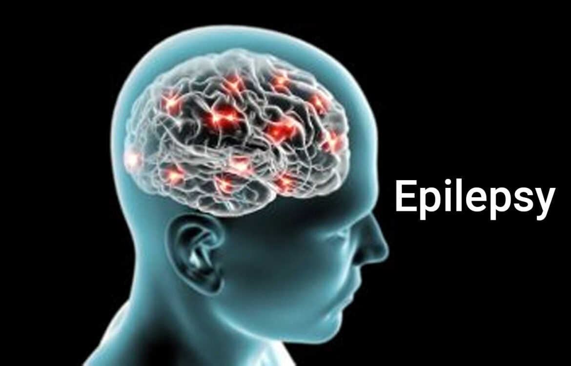 epilepsy