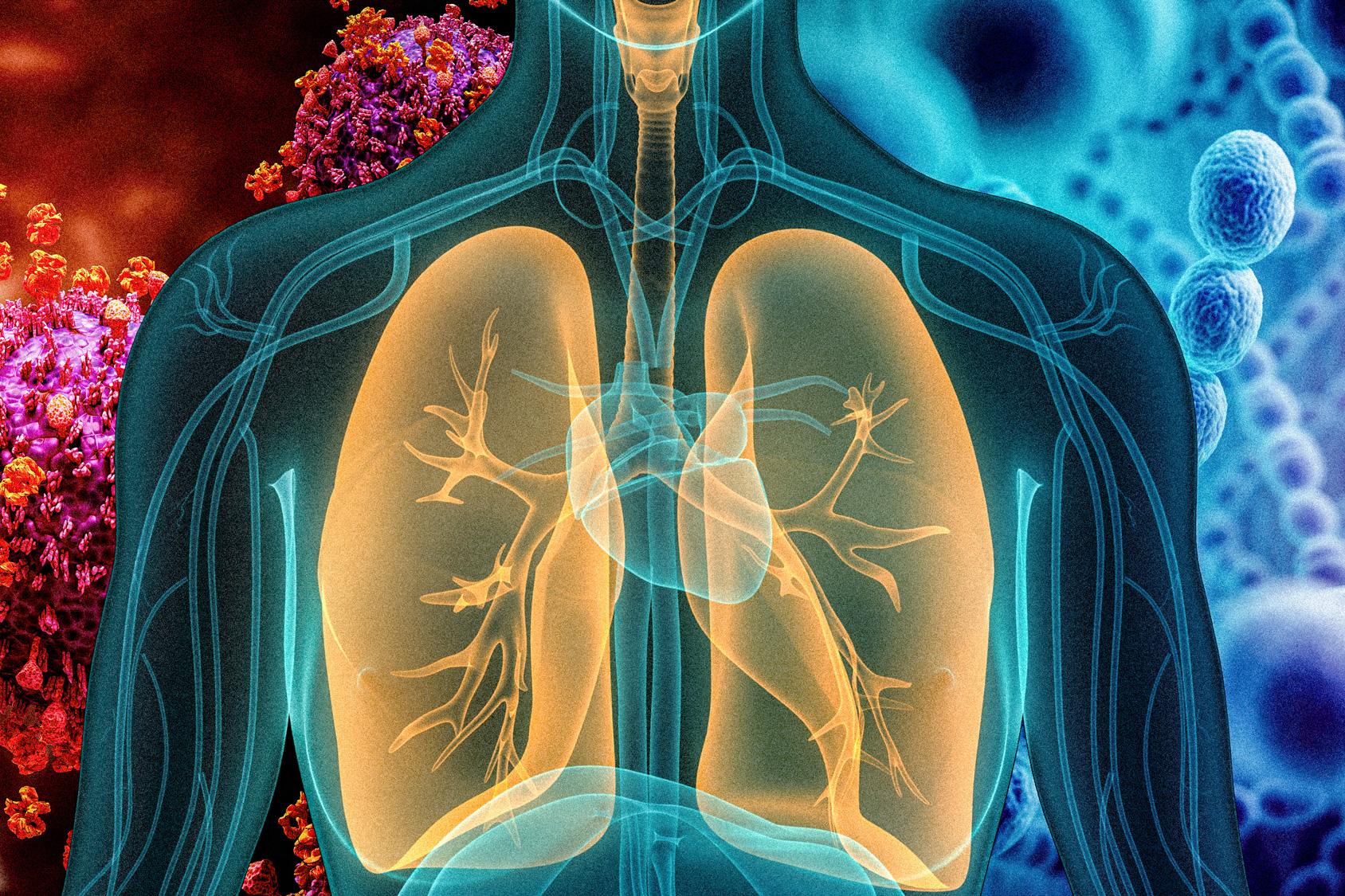 PNEUMONIA AND ITS AYURVEDIC MANAGEMENT Chandigarh Ayurved