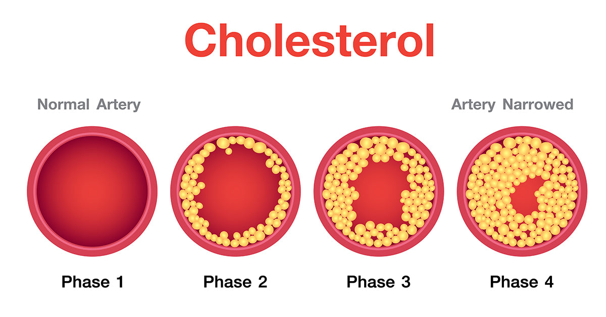 WHAT IS HIGH CHOLESTEROL? | Chandigarh Ayurved & Panchakarma Centre